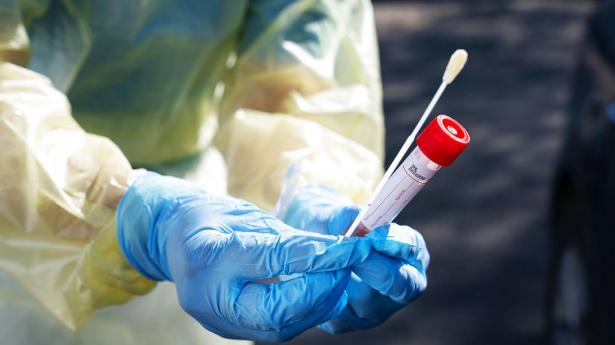 Testen udvikles med støtte fra Carlsbergfondet i et samarbejde mellem Rigshospitalet, Københavns Universitet og Novo Nordisk. Foto: Claus Bech/Ritzau Scanpix